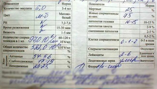 Что такое семенная жидкость у женщины