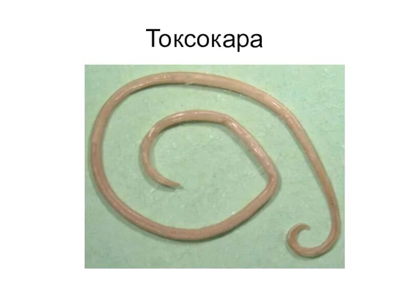 Аскарида класс. Тип круглые черви аскарида человеческая. круглый червь человеческая аскарида. тип круглые черви человеческая аскарида 7 класс.