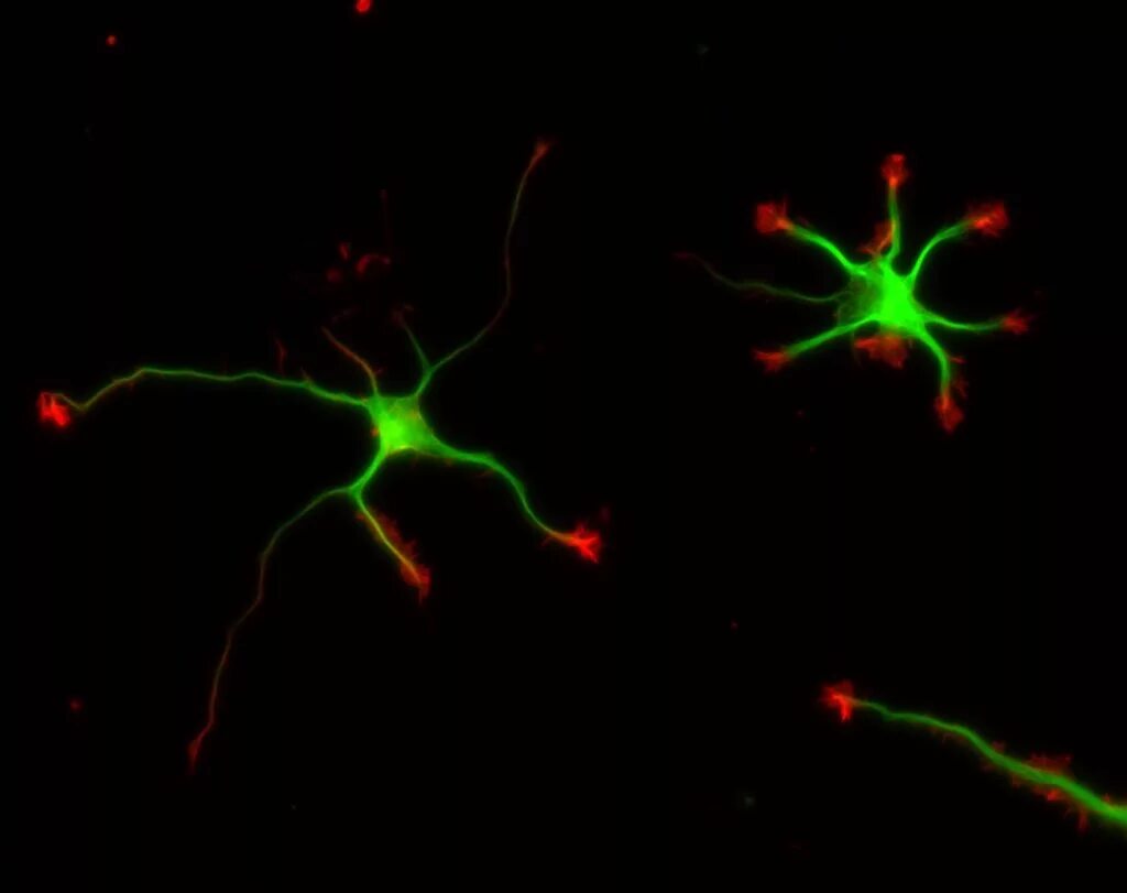 Красные Нейроны. Нейроны гиф. Нейронауки. Контакты между нейронами.