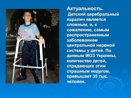 Дцп динамика