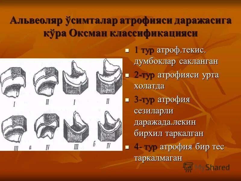 Типы атрофии по оксману. Классификация суппле. Классификация беззубых нижних челюстей по келлеру. Классификация беззубых челюстей по оксману. Классификация беззубых челюстей по оксману.