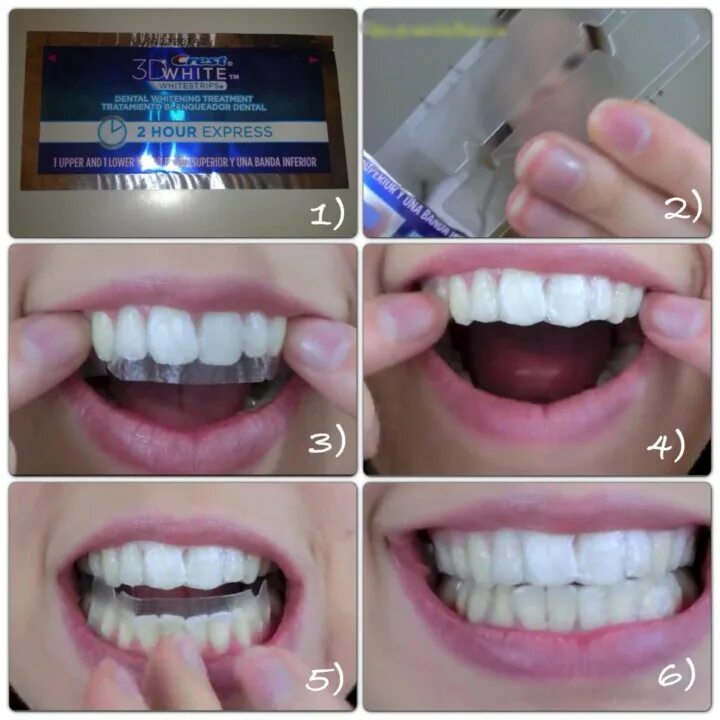 Пластинки для отбеливания зубов. Отбеливающие полоски для зубов. Отбеливающие полоски для зубов до и после. Полоски для отбеливания зубов до и после.