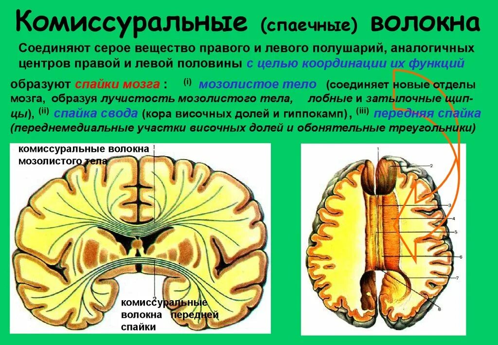 Спайки головного мозга. Комиссуральные волокна головного мозга. Комиссуральные проводящие пути головного мозга. Комиссуральные нервные волокна головного мозга, их строение.. Волокна белого вещества ассоциативные комиссуральные.