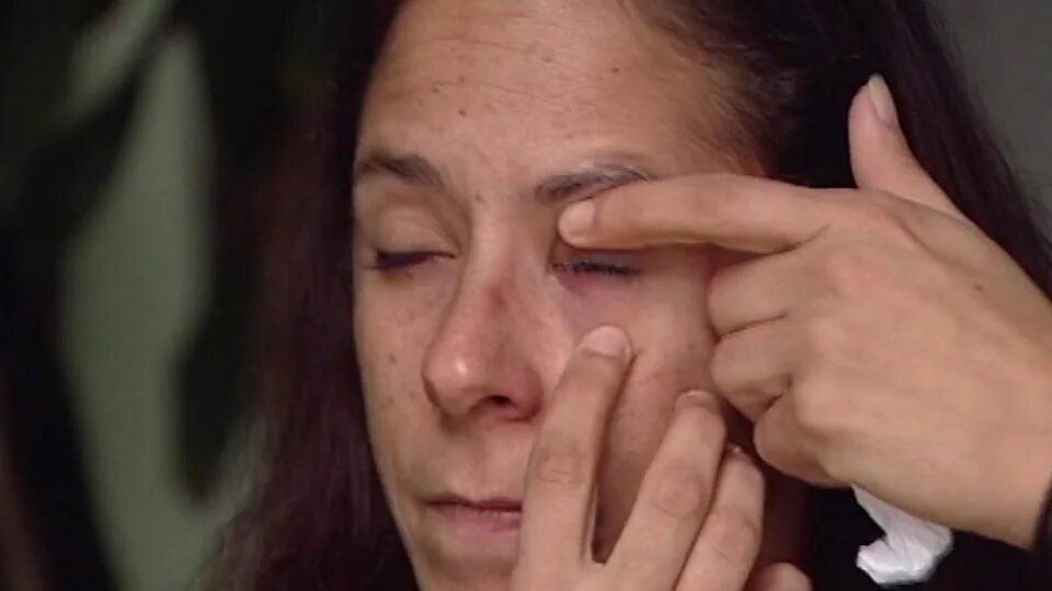 Капли для глаз от ожога клеем. Суперклей в глаза. Женщина случайно заклеила себе глаз. Суперклей в глаза. Суперклей в глаза.