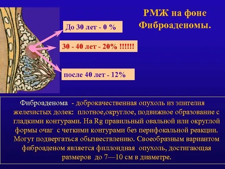 Фиброаденома молочной железы Строма. Доброкачественные новообразования молочной железы. Фиброаденома патогенез. Фиброаденома молочной железы патогенез.