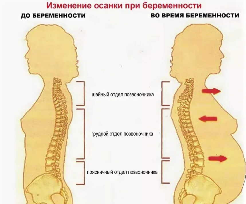 Боли в спине после родов. Беременность и позвоночник. Позвоночник беременной женщины. Изменения позвоночника у беременных. Изменение осанки при беременности.