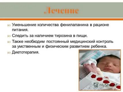 Фенилкетонурия лечение
