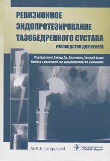 Ревизия сустава
