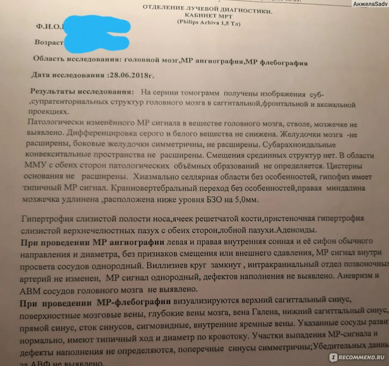 Делают ли мрт под наркозом. Мрт головного мозга под наркозом детям. наркоз детям при проведении мрт. согласие на кт мрт. показания к кт головного мозга.