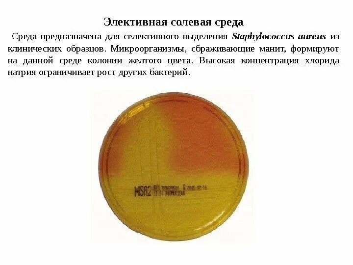 Аэромед соляные комнаты. Соляная пещера обитаемая среда волгоград. Соляные пещеры в волгограде. Фтористоводородная кислота ожоги. Солевой агар с маннитом.