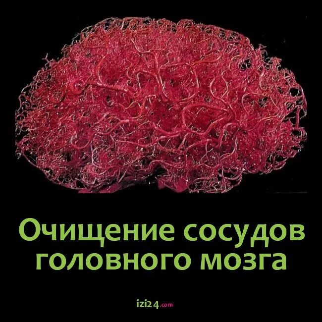 Сосуды головного мозга лечение народными. Очищение сосудов головного. Чистка сосудов головного мозга. Кровеносные сосуды головного мозга.