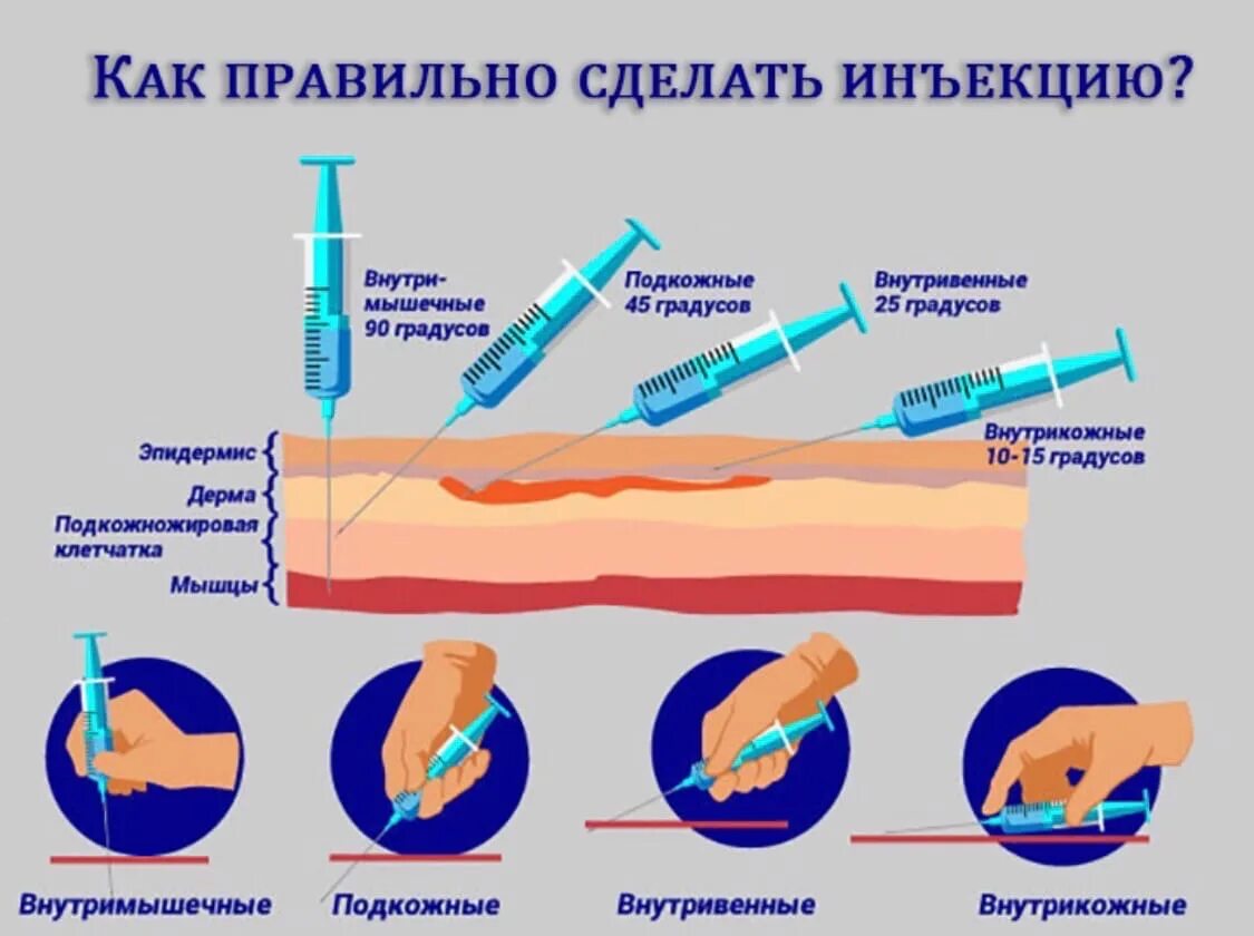 Как держать иглу. Внутривенная инъекция глубина введения иглы. Подкожный укол инсулиновым шприцом. Угол наклона иглы при внутривенных инъекциях:. Глубина введения подкожной инъекции.