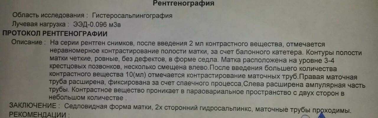 Гидросальпинкс ГСГ рентген. Протокол ГСГ. Гистеросальпингография заключение. Гистеросальпингография протокол. Гидросальпинкс лечение операции