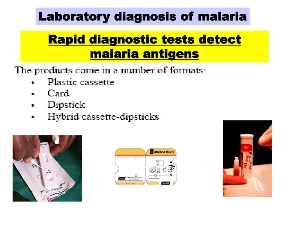Малярия тестирование. Malaria diagnosis. Laboratory diagnosis. Rapid Diagnostic Test. Malaria Rapid Diagnostic Test.