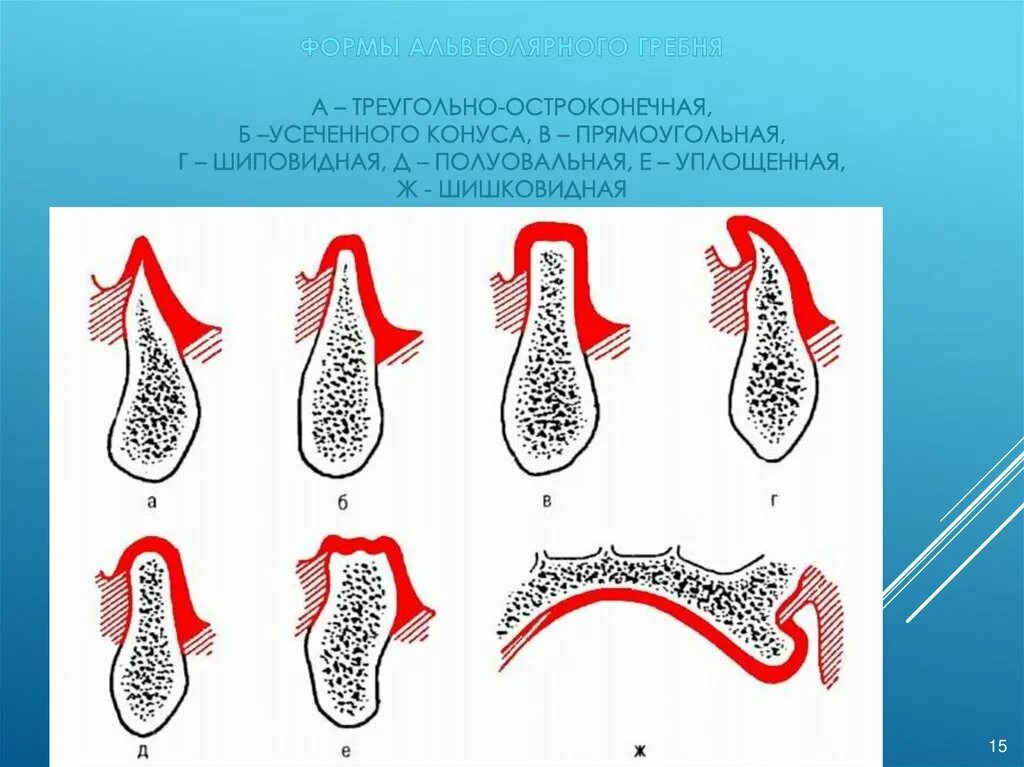 Строение художественной кисти. Клинические формы бородавок. Пинцет хирургический цапки. Твердосплавные 20—32-гранные финиры. Пинцет хирургический 1х2 зубчато-лапчатый 150х2,5.