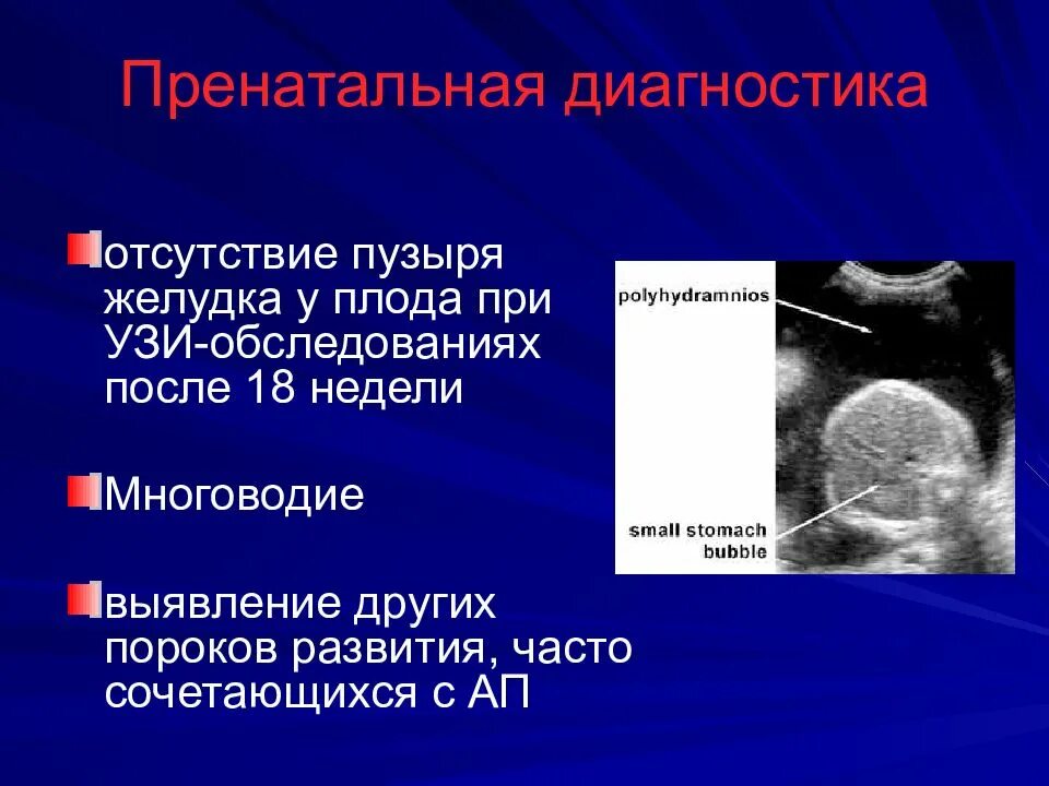 Пути проникновения внутриутробной инфекции. Пороки развития плода на узи. Методы пренатальной диагностики узи. Внутриутробная диагностика плода. Внутриутробная диагностика плода.