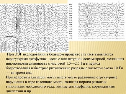 Нерегулярные данные