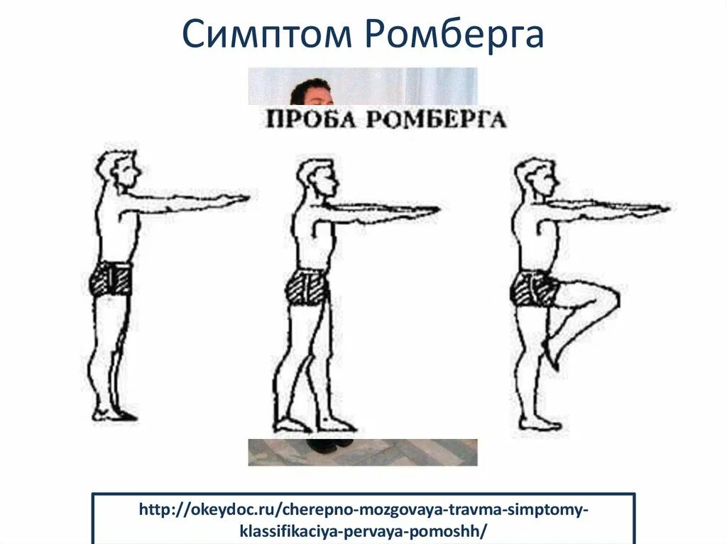 Использование пробы ромберга для определения координации. Статическая балансировка проба ромберга. Пяточно-носочная проба (проба ромберга). Равновесие проба ромберга. Проба ромберга 2.