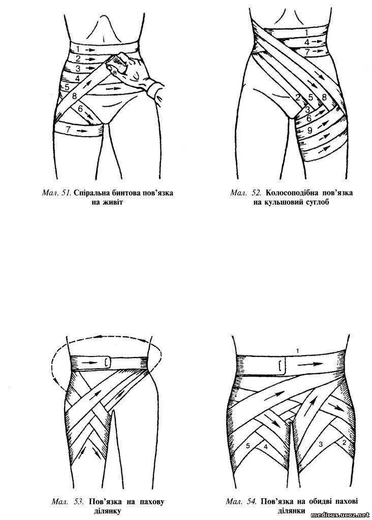 Бедренная перевязка. Колосовидная повязка на паховую область. Колосовидная повязка на бедро. Колосовидная повязка на бедро и паховую область. Колосовидная перевязка на бедро.