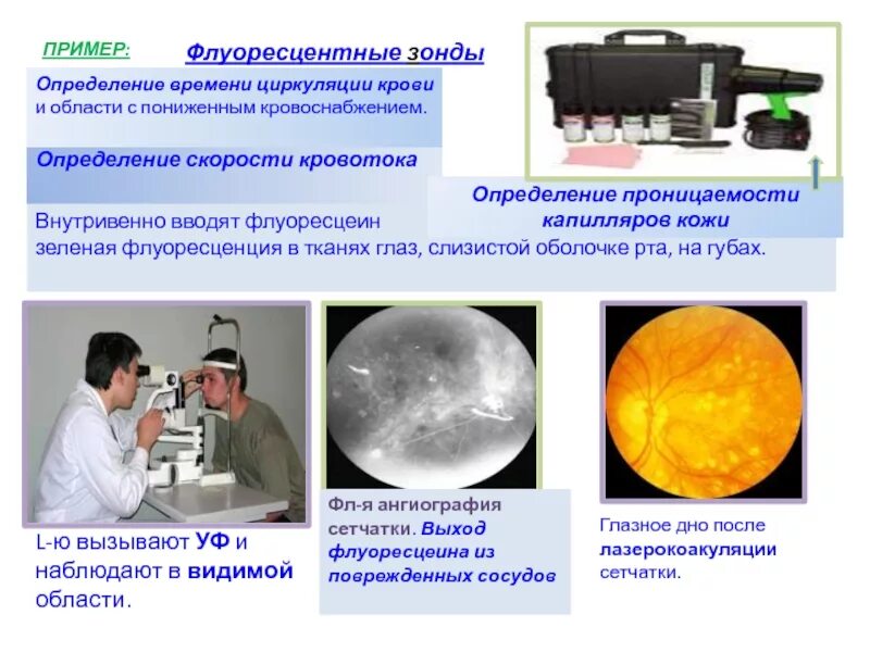 Зонд определение