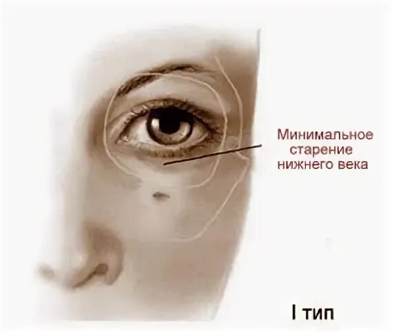 Как изменяются века. Круговая мышца глаза возрастные изменения. Гипертонус круговой мышцы глаза.