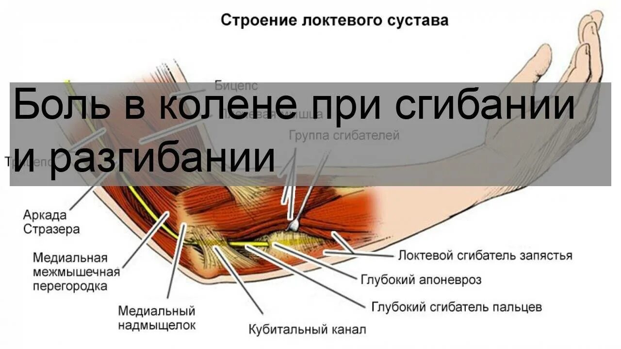 Сильные боли при разгибании колена. Боли в коленном суставе при сгибании и разгибании. Болит колено при сгибании. Боль в колене при сгибании и разгибании. Боли при згибании и разгибание в колене.