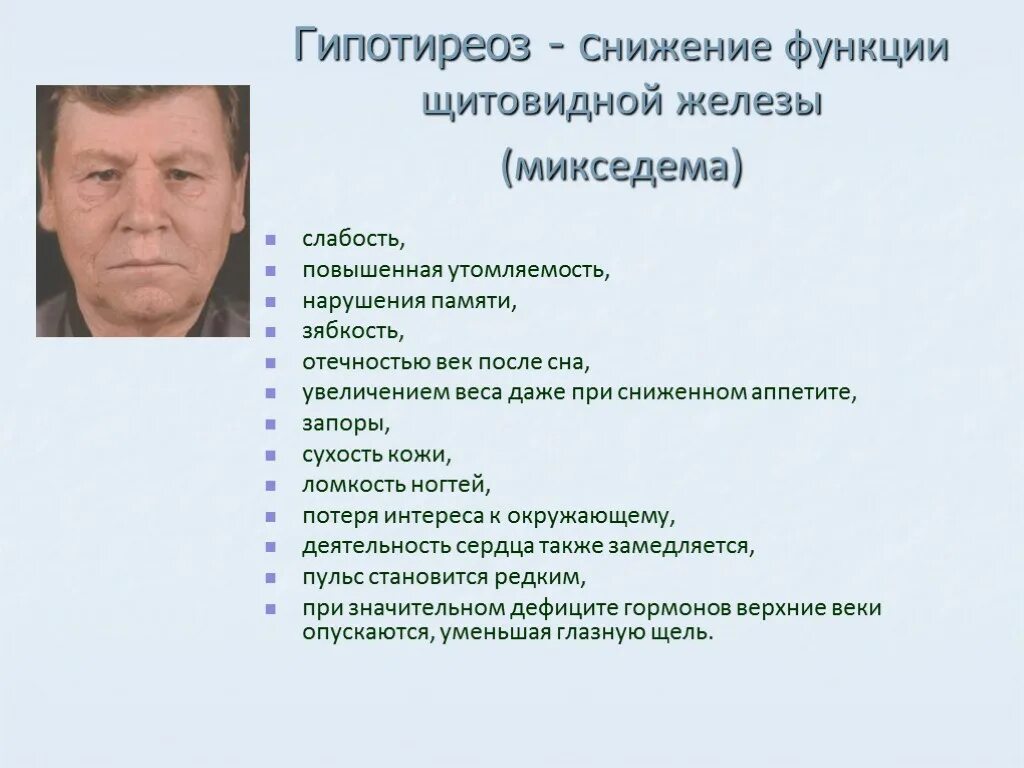 Гипотиреоз б. Снижение функции щитовидной. Сниженная функция щитовидной железы. Понижение функции щитовидной железы. При снижении функции щитовидной железы характерно.