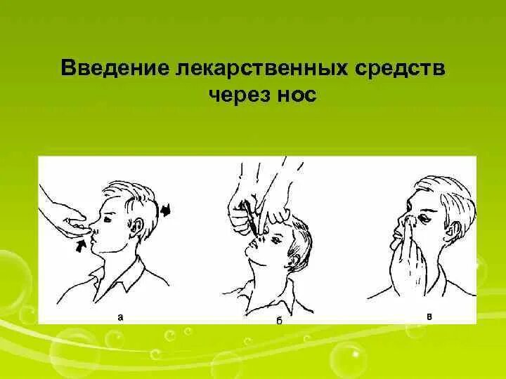 Капли в нос в глаза алгоритм. Введение лекарственных средств в нос. Введение лекарственных средств в полость носа. Введение лекарственных средств через нос. Введение лекарственных средств в нос алгоритм.