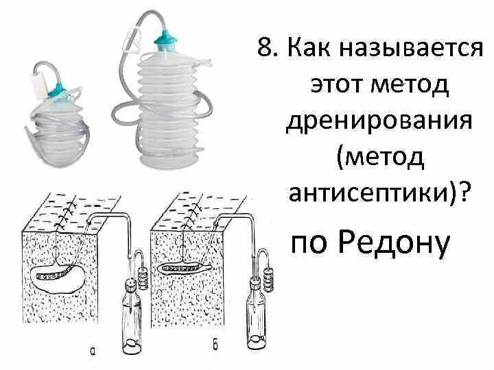 Дренаж по редону. Вакуумное дренирование по редону. активное дренирование раны по редону. вакуумный дренаж по редону. активный дренаж по редону.