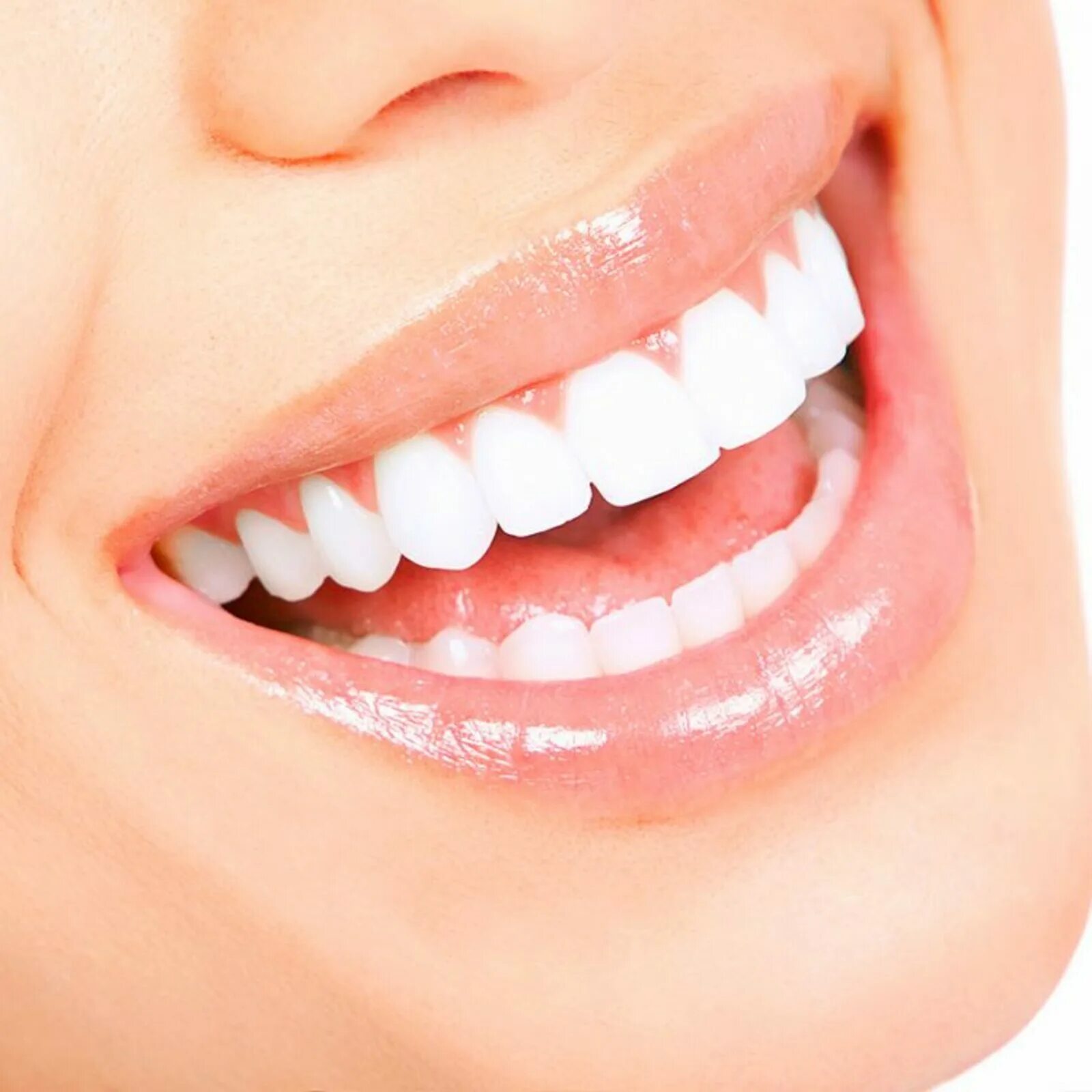 Smile design. Smile design