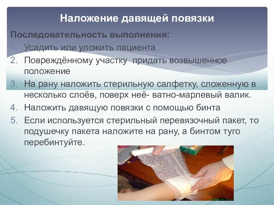 Алгоритм наложения. Порядок наложения давящей повязки. порядок надожение давящей повязки. правила положение давящей повязки. наложение давящей повязки алгоритм.