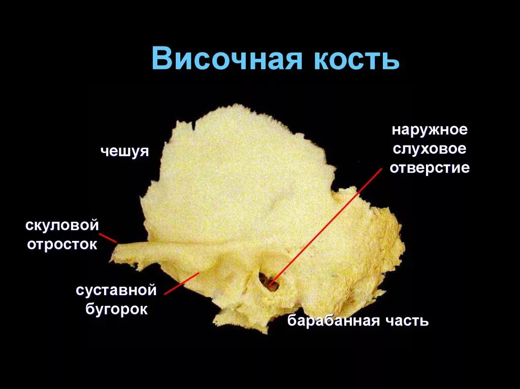 Fissura petrosquamosa. Чешуя височной кости анатомия. Сосцевидный отросток височной кости анатомия. Височная кость это. Шиловидный отросток височной кости анатомия.