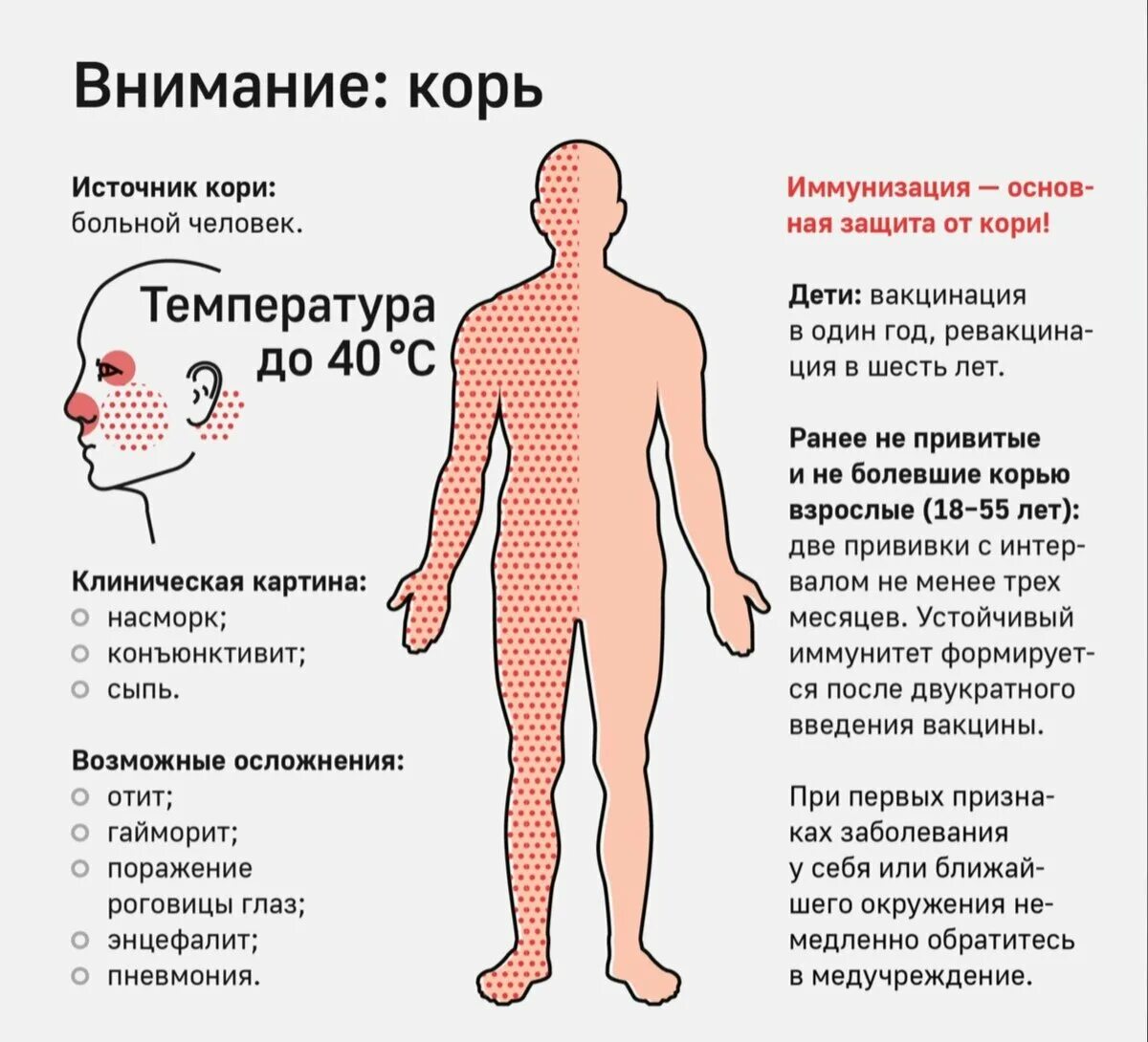 Осложнения кори у взрослых. Корь клиническая картина. Корь симптомы у детей и взрослых.