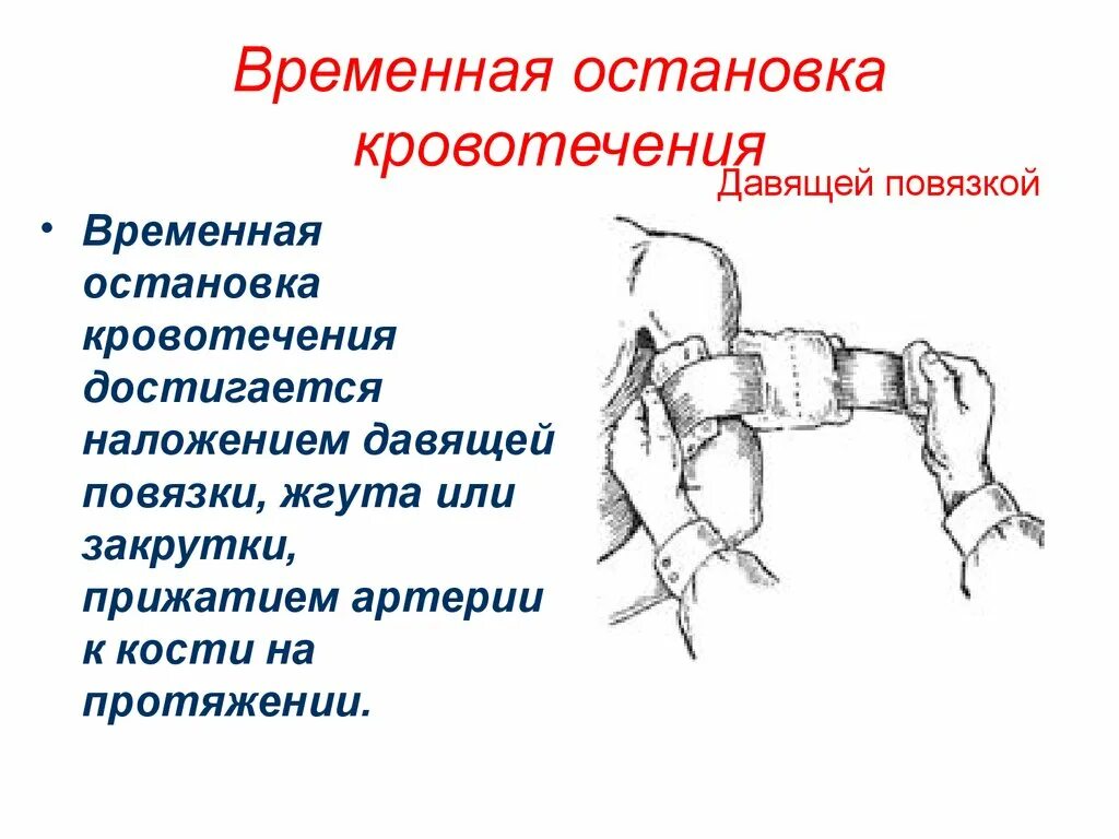 Давящая повязка метод остановки кровотечения. Временная остановка кровотечения жгута закрутки. Способы временной остановки кровотечения наложение жгута. Временная остановка кровотечения давящей повязкой. Способы временной остановки кровотечения наложение давящей повязки