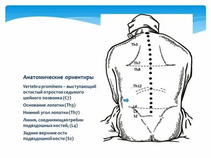 Обезболивание позвоночника