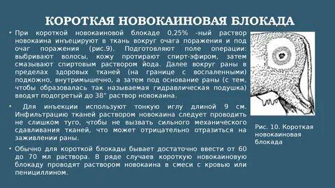 Блокада после операции