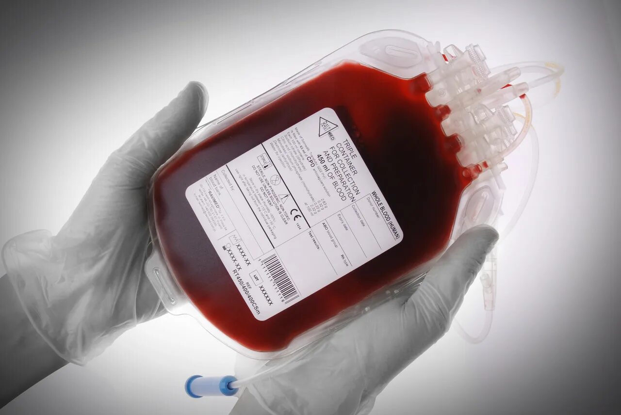 1 грамм крови. Контейнер для крови сдвоенный 450/300 мл ЦФДА-1. 450 Мл пакет крови. Контейнер для цельной крови.