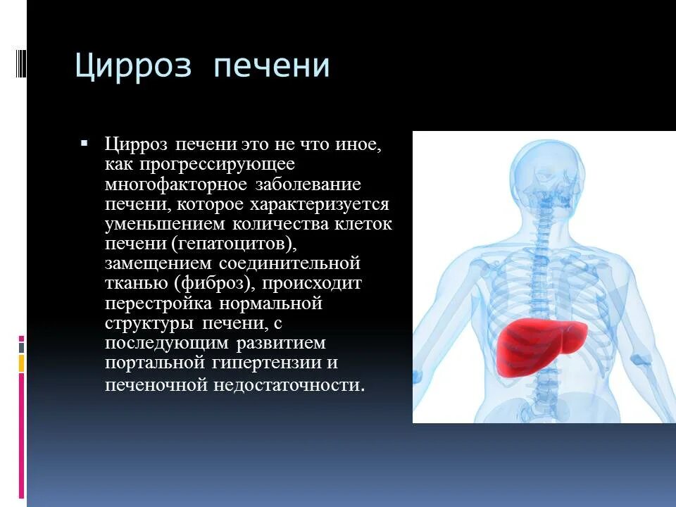 Алкогольный цирроз симптомы у мужчин. Цирроз печени заключение. Заключение при циррозе печени.