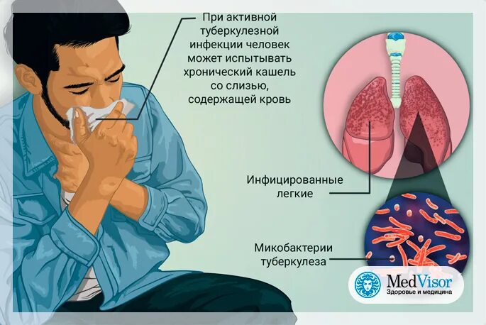 Сухой и влажный кашель. Температура 37 подкашливает. Сопли и кашель без температуры у ребенка. Симптомы при температуре 37 5 у взрослого. Сопли кашель и температура 37.