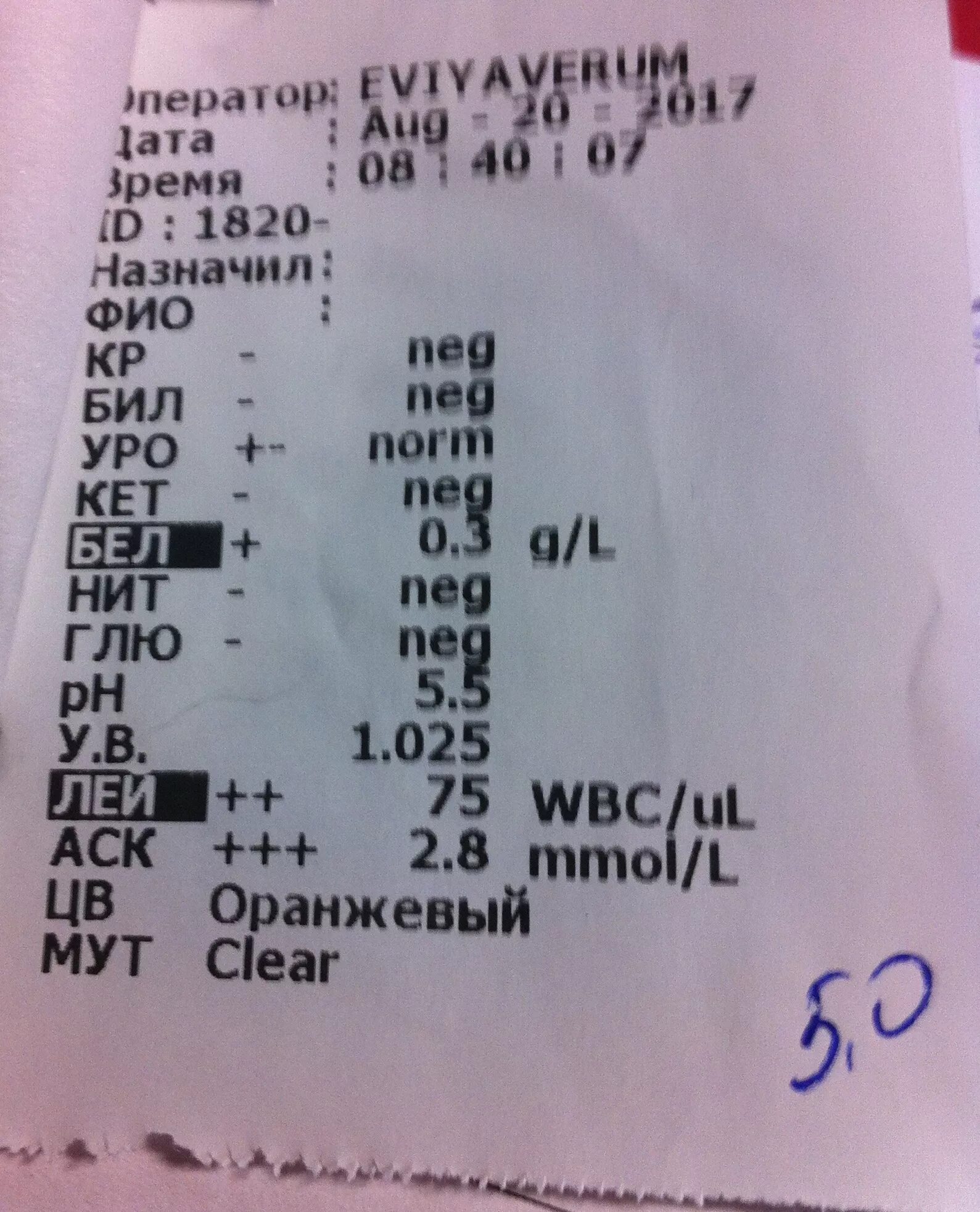 Что означает аск. Анализ мочи. Uro в анализе мочи. Анализ мочи расшифровка АСК норма. ACK В анализе мочи что это.