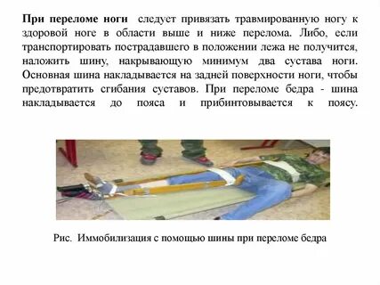 Страховка при переломе ноги