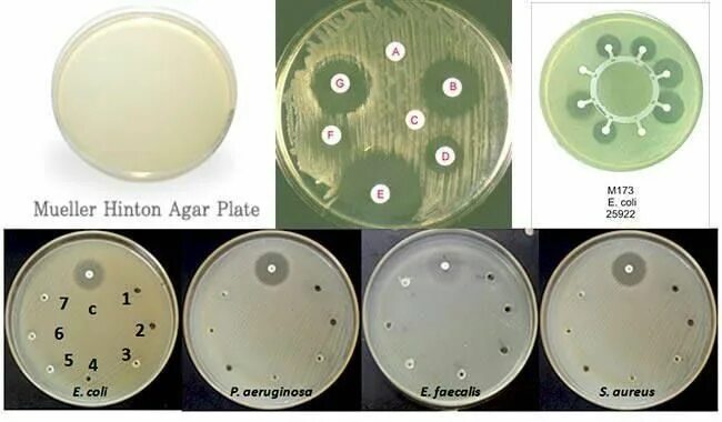 Шкала агар. Агар мюллера-хинтона микробиология. pseudomonas aeruginosa на чашке петри. среда мюллера хинтона микробиология. чашка петри с агаром.