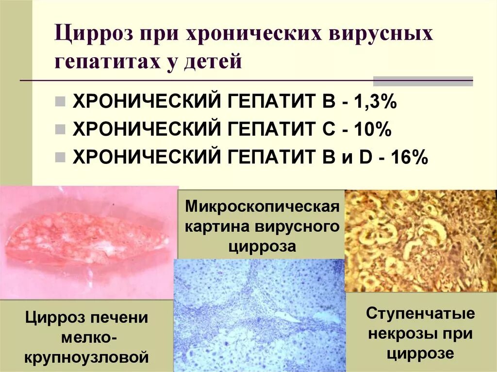 Что означает хронический гепатит вирусный. Мелко крупноузловой цирроз печени. хронический вирусный гепатит. хронические гепатиты уирс.