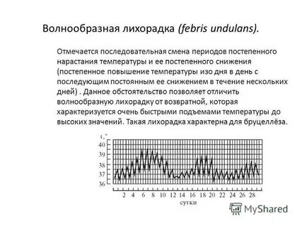 Температура при артрите