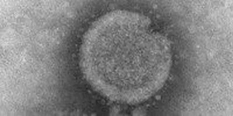 H5n1 virus