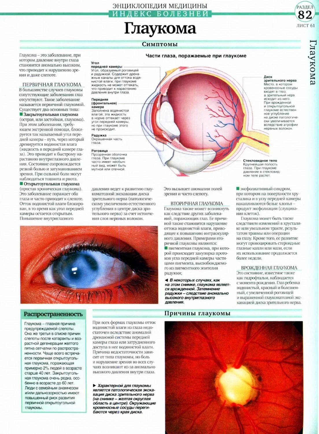 Заболевания глаз список. Глаукома памятка. Плакат глазные болезни. Глаукома плакат.