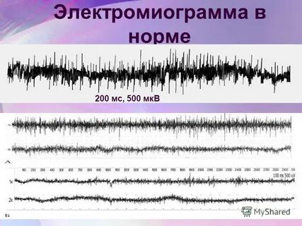 200 нормально