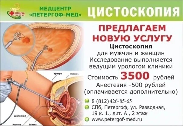 Цистоскопия мочевого пузыря у женщин как делают. Обследование мочевого пузыря цистоскопия. цистоскоп для мочевого пузыря. цистоскопия мочевого пузыря у женщин.