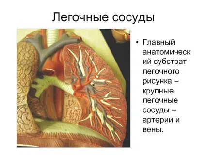 Главный сосуд