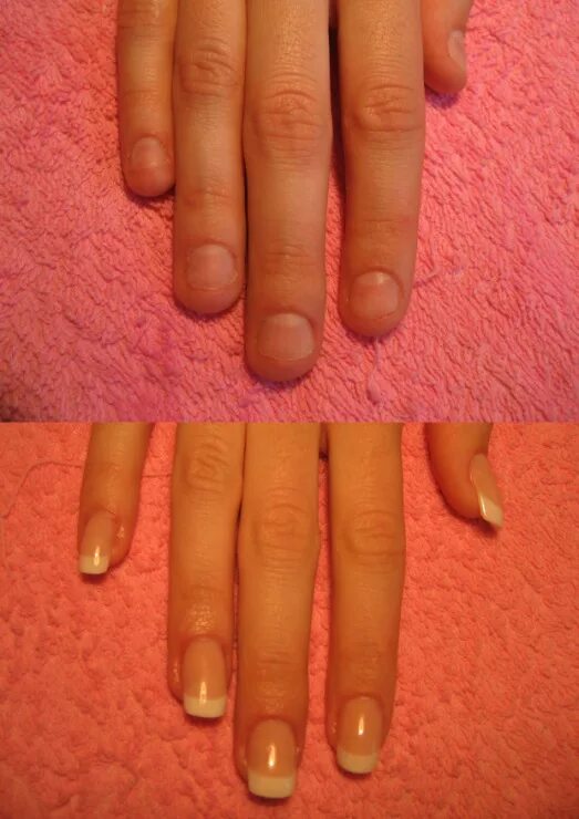 Как нарастить ногти под корень. Ноготь сломался под корень. Как нарастить ногти под корень. Нарощенные ногти быстро ломаются. Восстановление сломанного ногтя.